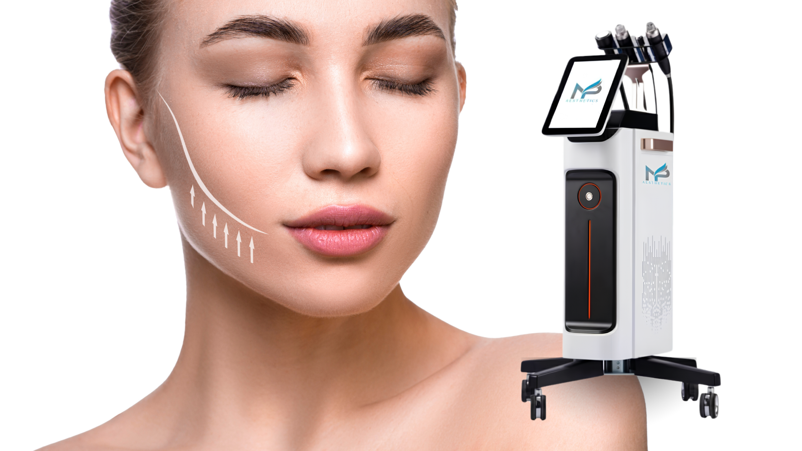 Proteus-V RF Microneedling (Face) Package