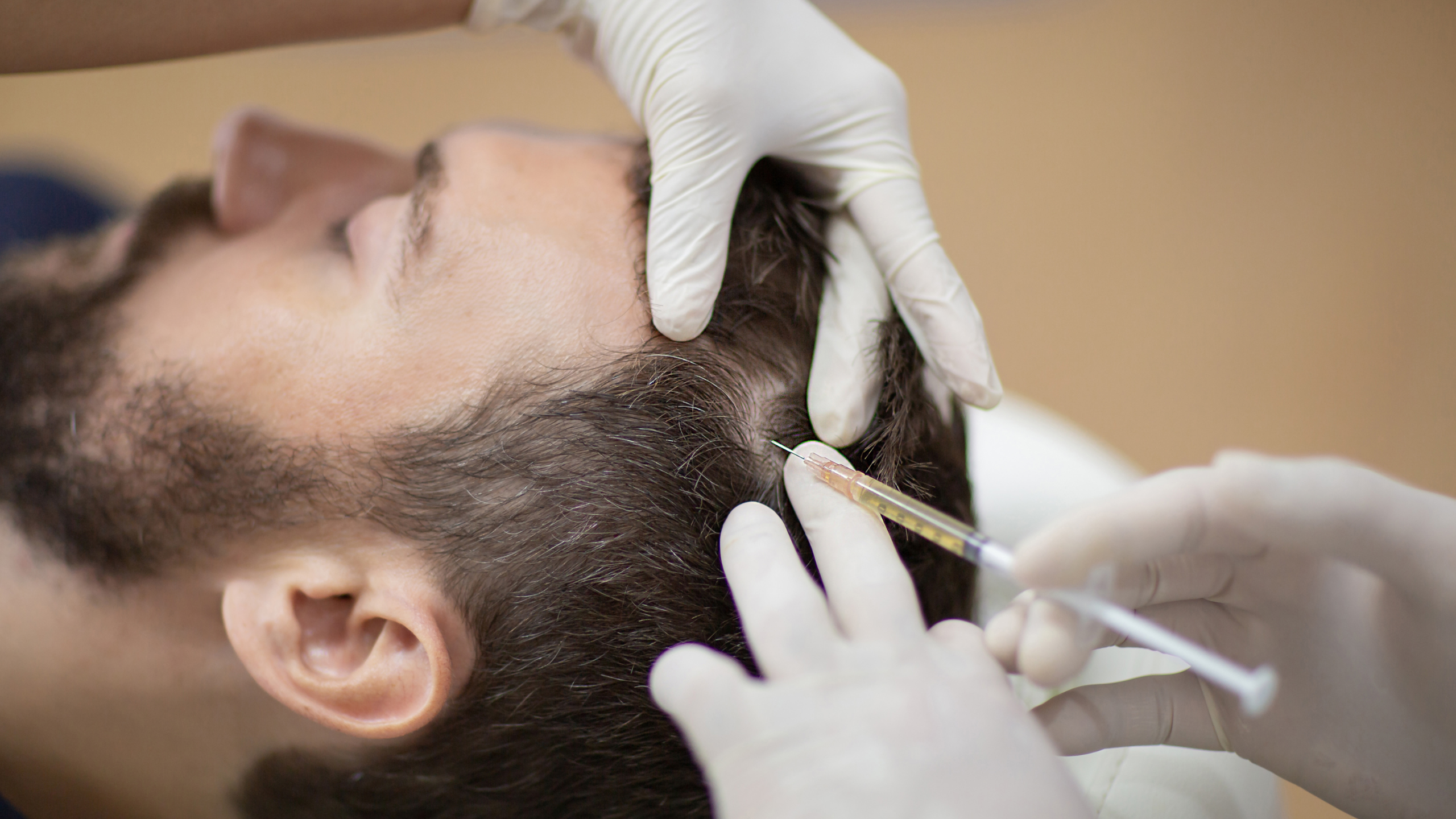PRP to Scalp/Hair Package