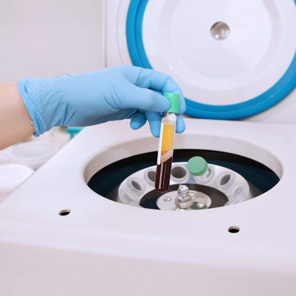Platelet-Rich Plasma
