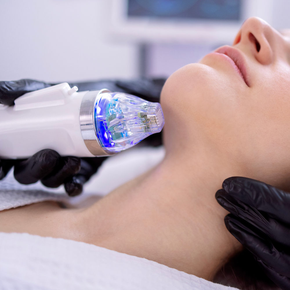 Collagen-Induction Therapy